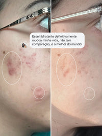 Hidra Clear - Hidratante Uniformizador